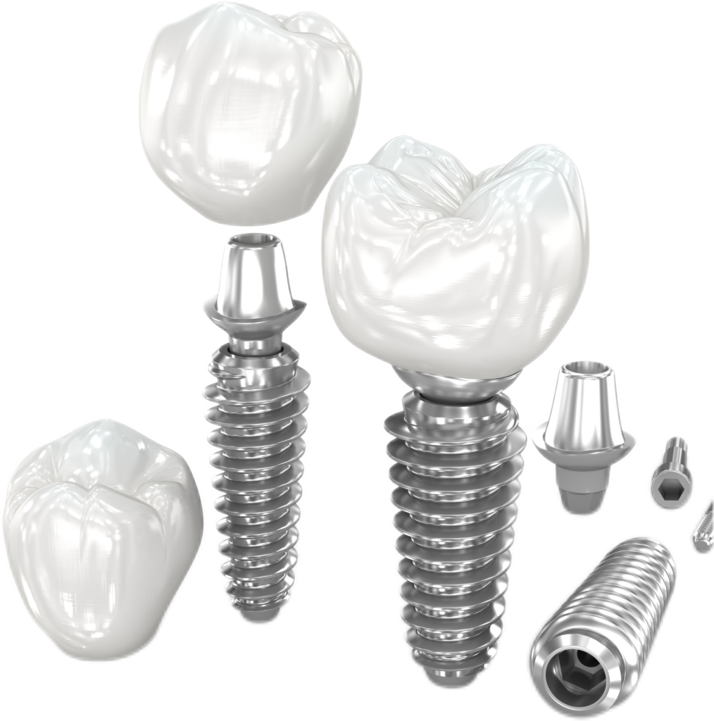 3d transparent image of singular dental implants